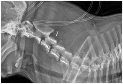 Case report: Traumatic hemorrhagic cervical myelopathy in a dog